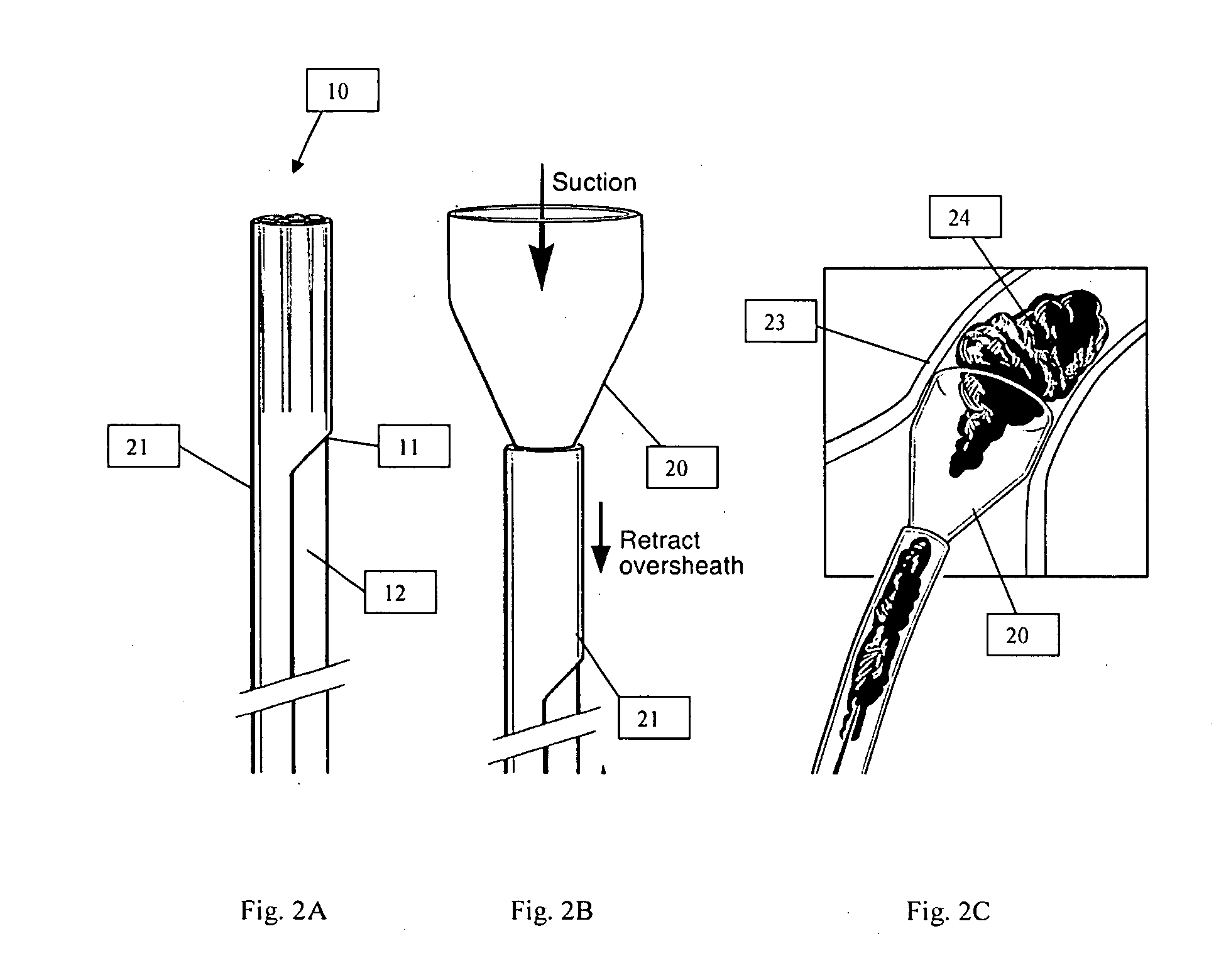 Systems and methods for removing undesirable material within a circulatory system