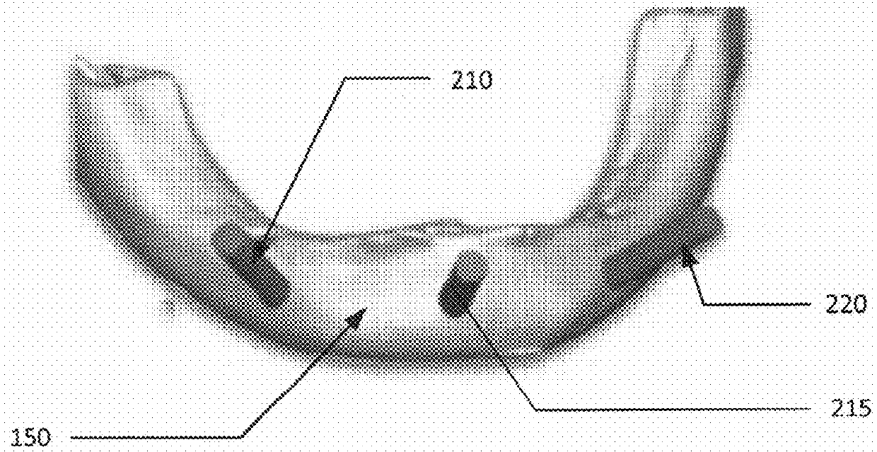 Surgical Guide and Associated Process for Dental Implants