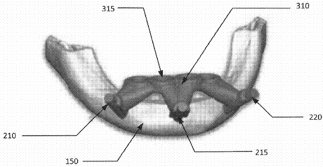 Surgical Guide and Associated Process for Dental Implants