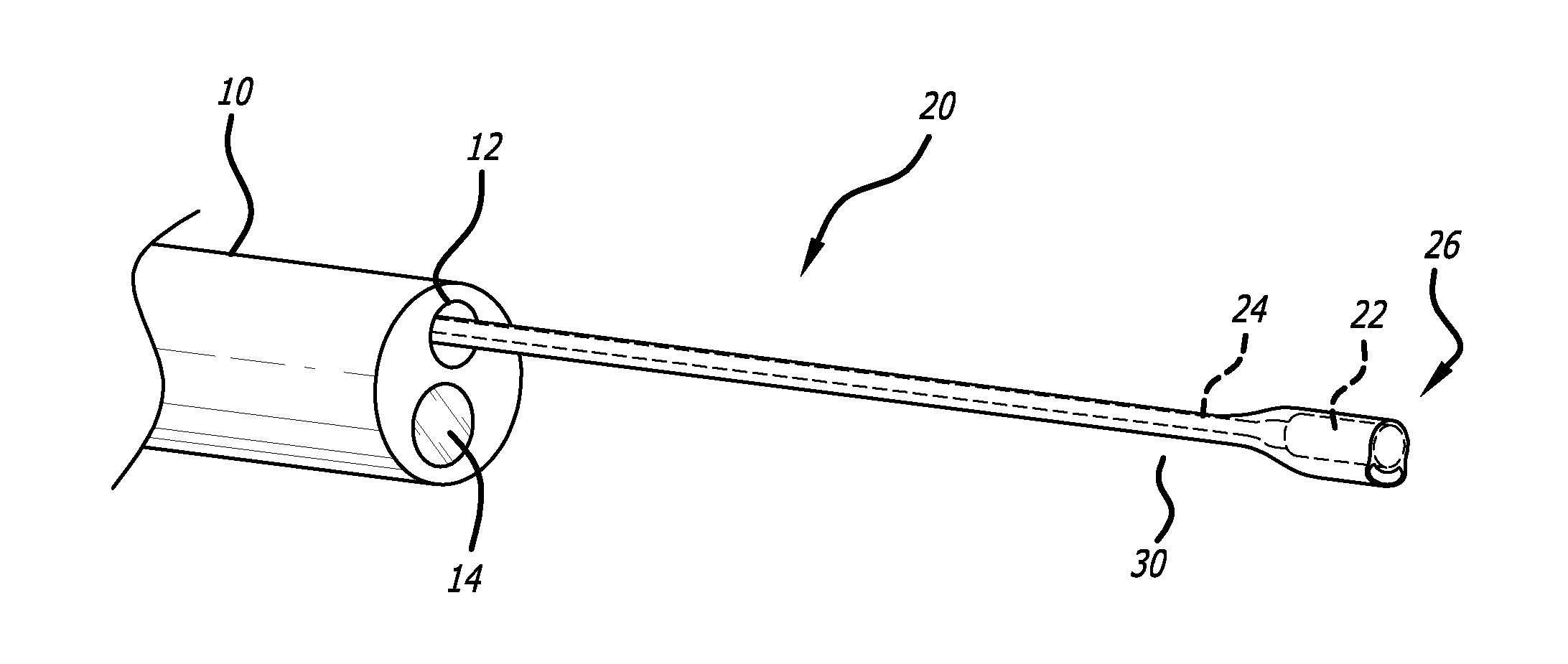 Locatable Expandable Working Channel And Method