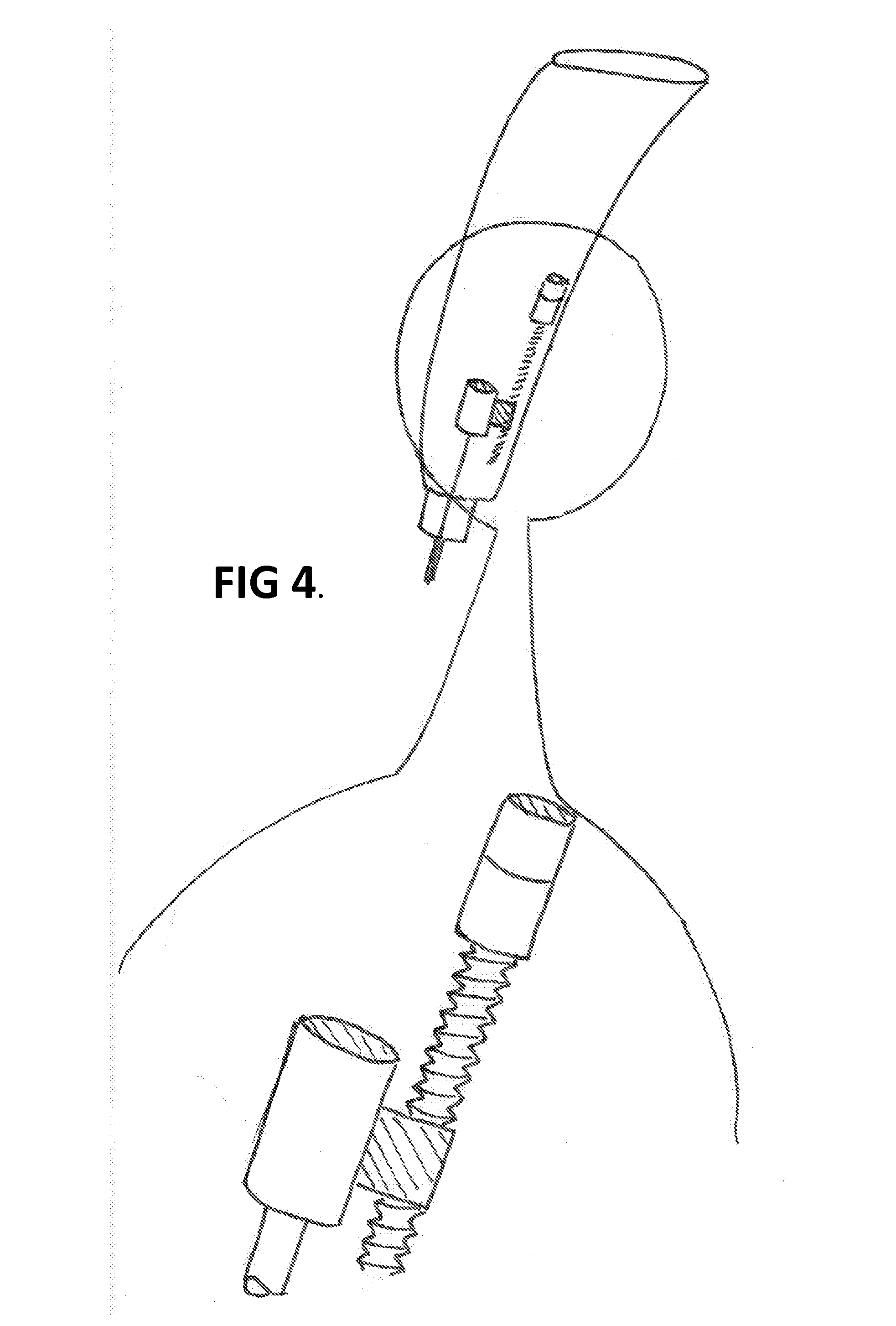 Medical Device for Controlled Nail Penetration