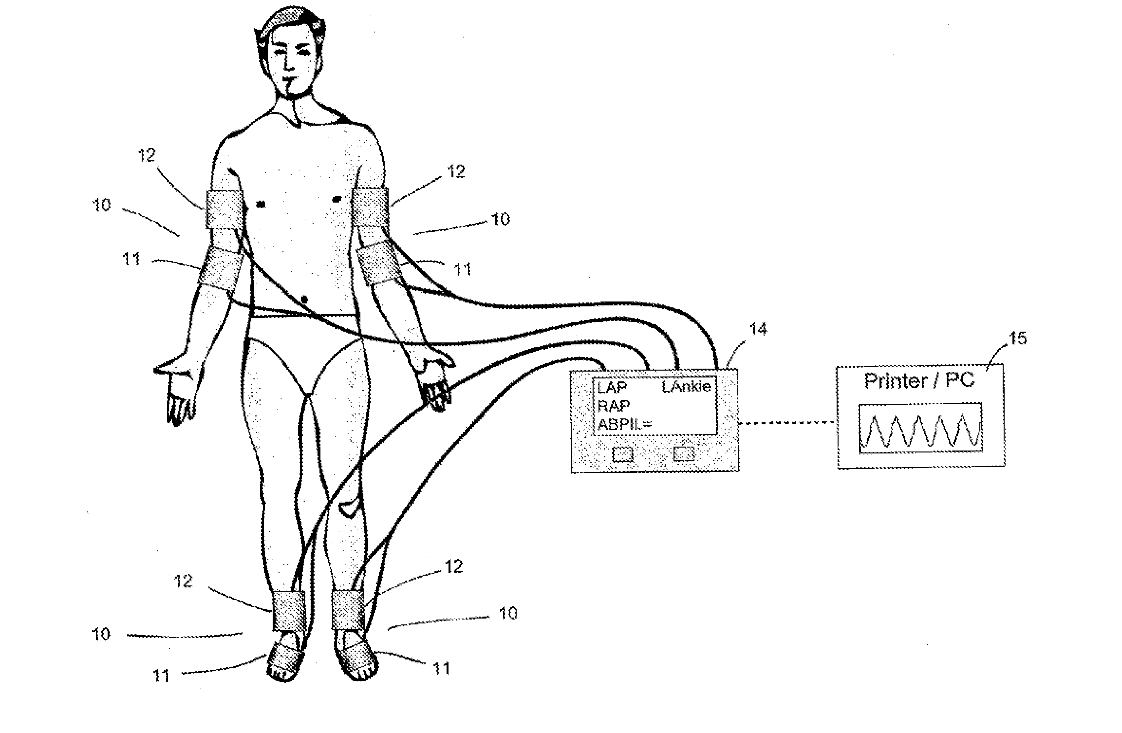 Automatic ankle brachial pressure index system