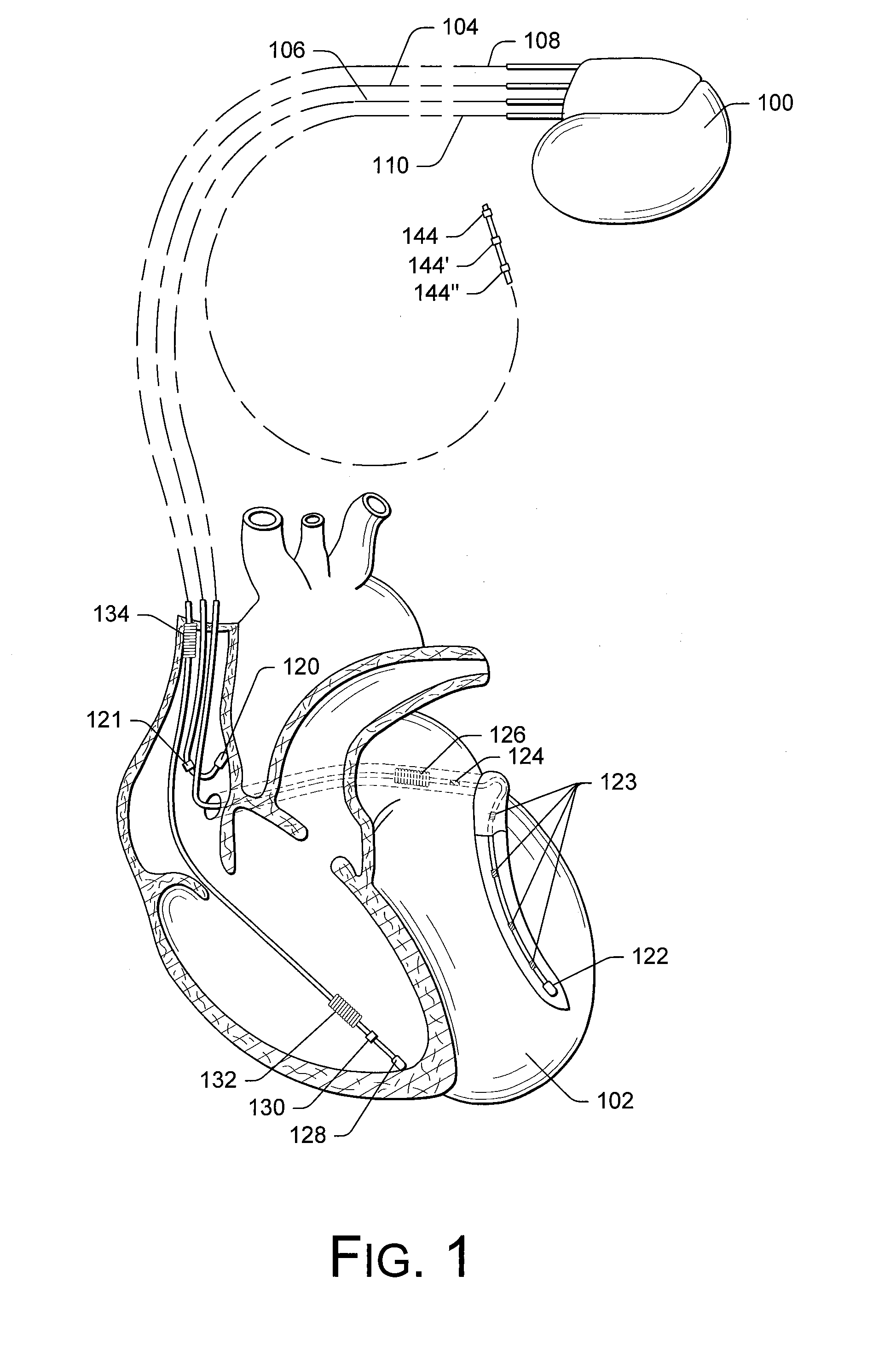 Cardiac resynchronization therapy optimization using mechanical dyssynchrony and shortening parameters from realtime electrode motion tracking