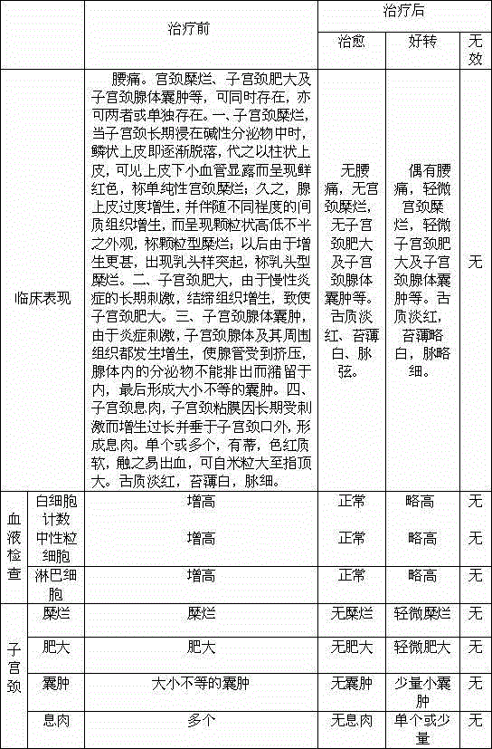 Preparation method of Chinese medicine irrigation solution for treating osphyalgia type chronic cervicitis