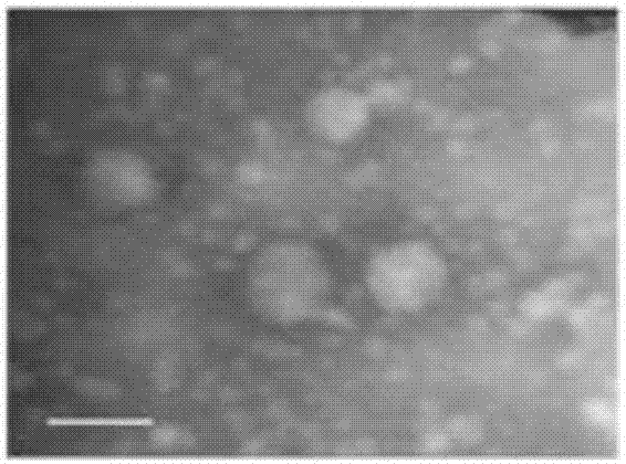 Application of adipose-derived mesenchymal stem cell exosome in preparation of medicines for treating adipose tissue inflammations