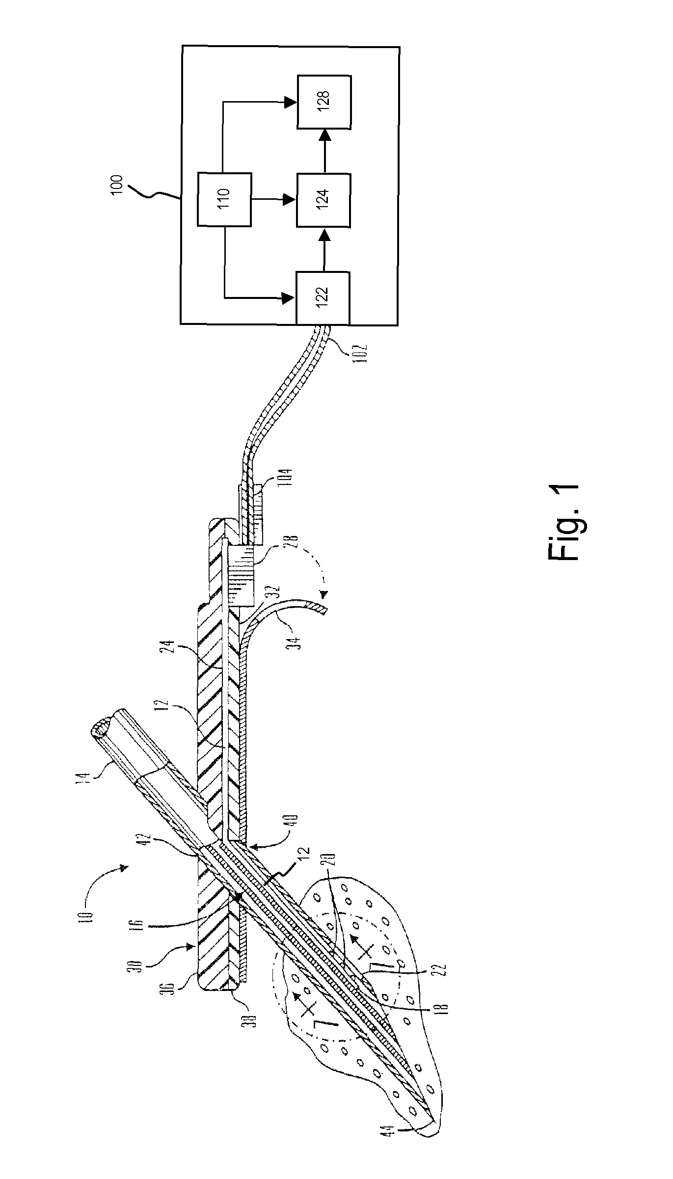 Method and system for detecting age, hydration, and functional states of sensors using electrochemical impedance spectroscopy