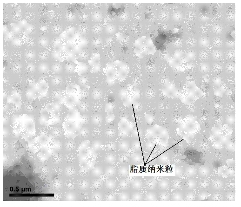 Asiatic acid lipid nanoparticle capable of stimulating oral absorption and preparation method thereof