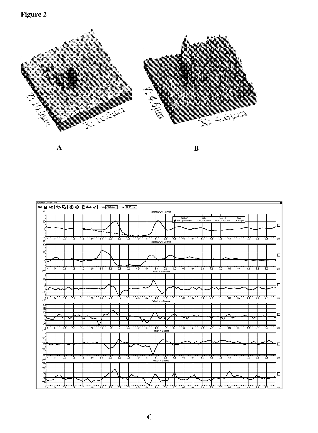 Biocoated piezoelectric biosensor platform for point-of-care diagnostic use