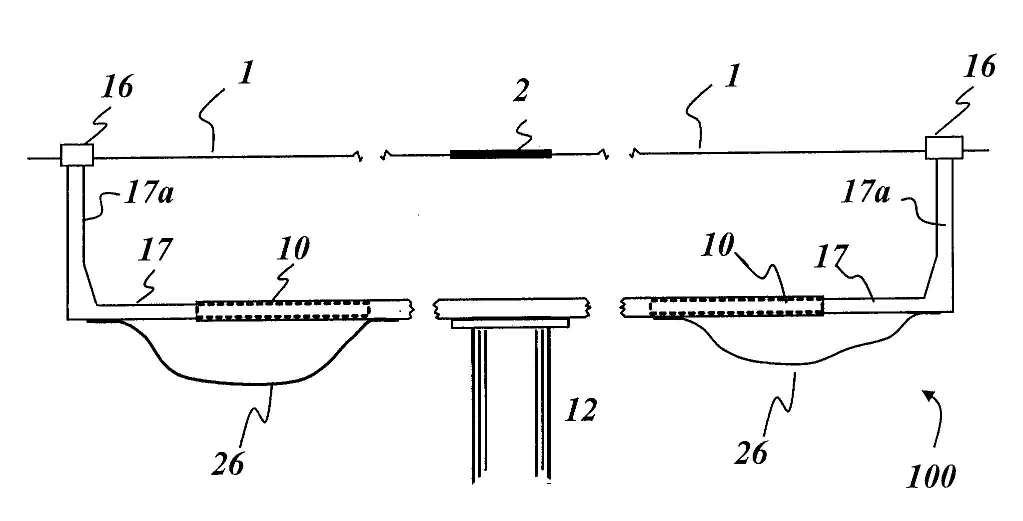 Robotic Bypass System and Method
