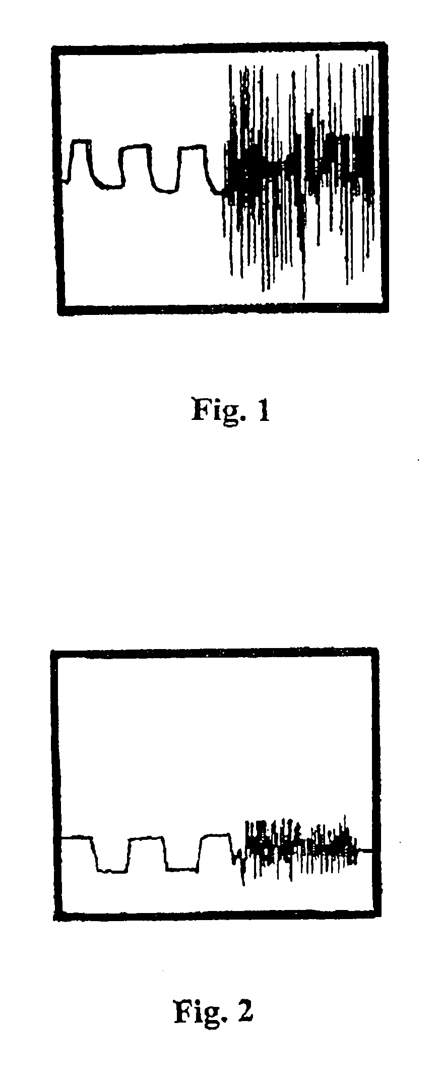 Plastically deformable implant