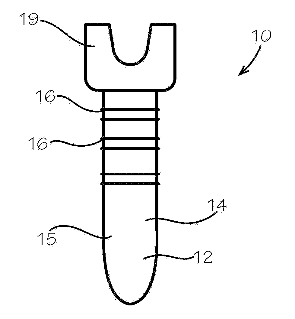 Bone fixation screw with deployable anchors