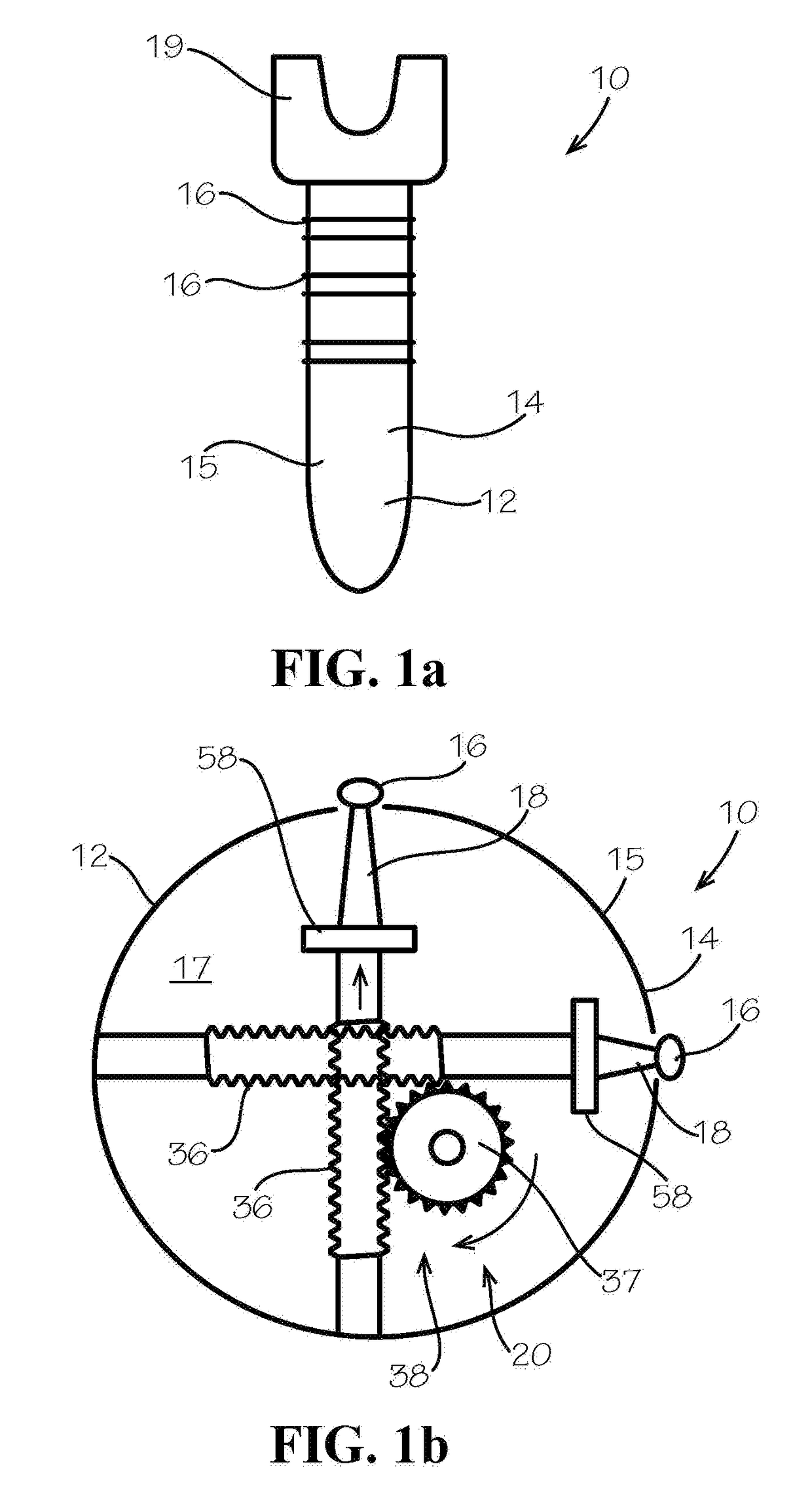 Bone fixation screw with deployable anchors