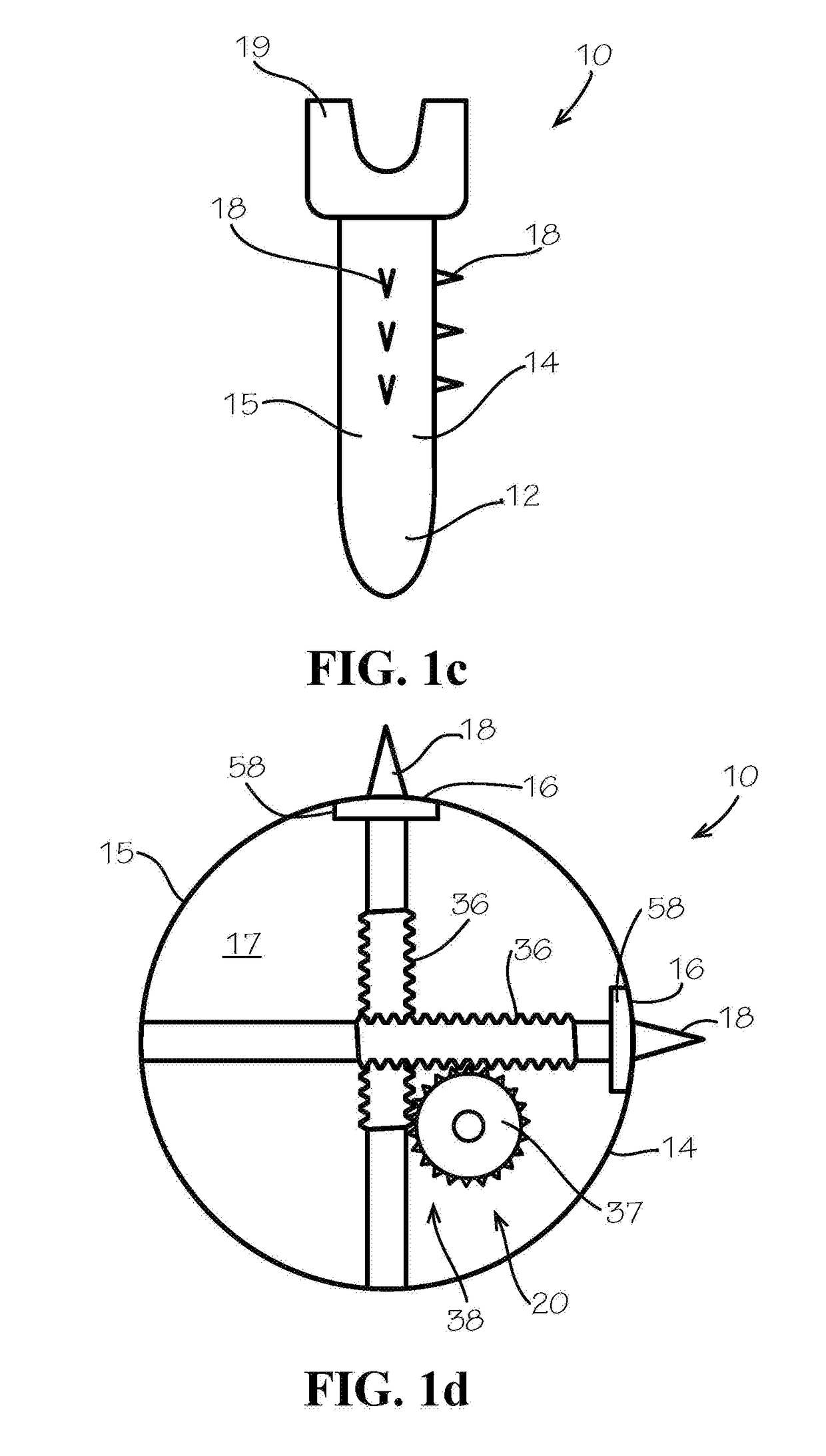 Bone fixation screw with deployable anchors