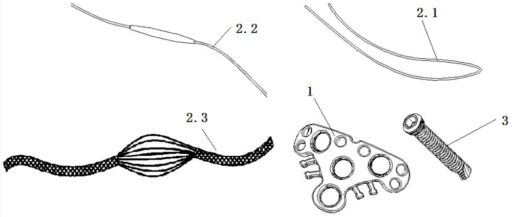 A Miniature Periarticular Injury Repair System and Its Locking Bone Plate