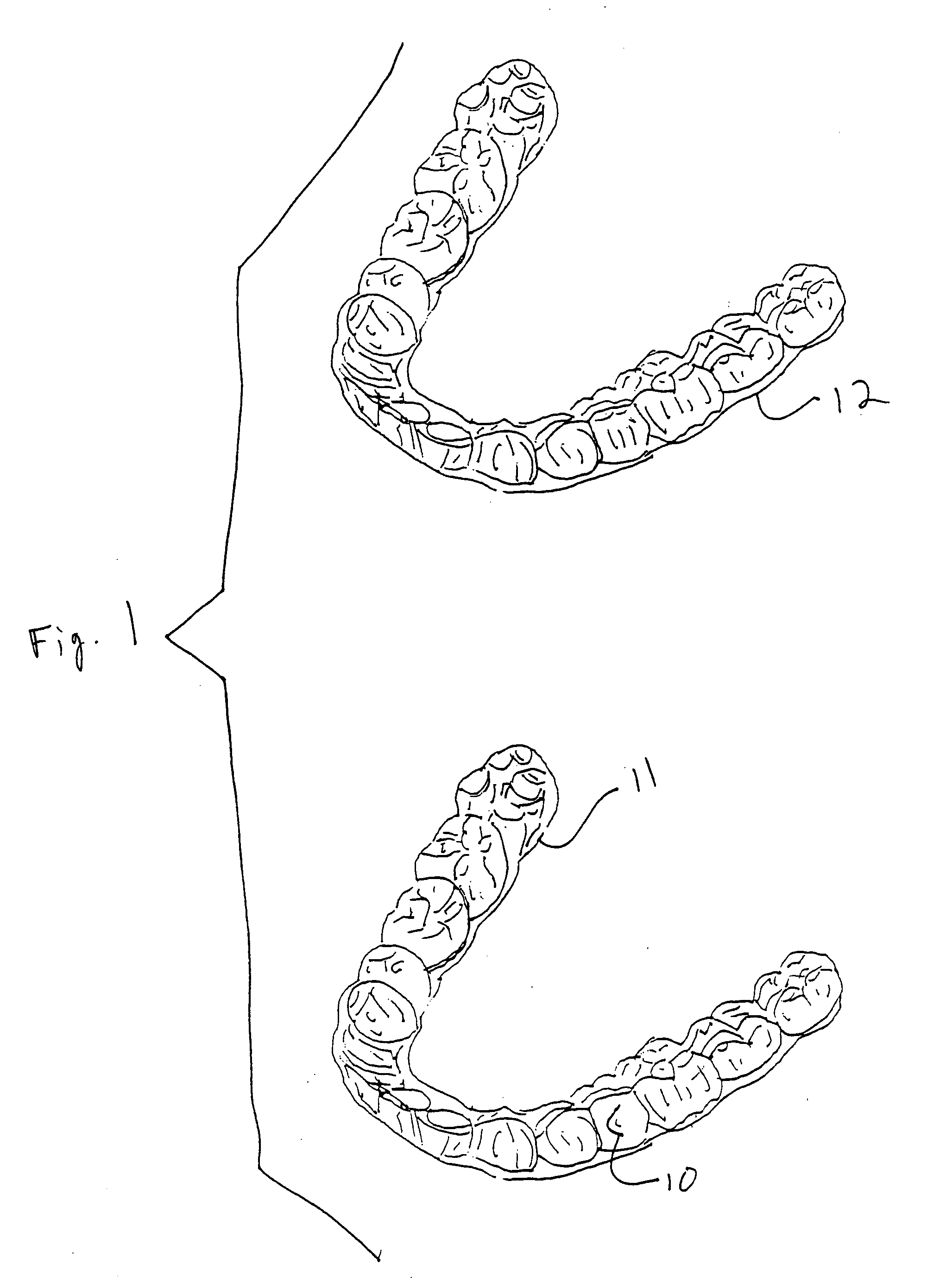 Method and system for personalized orthodontic treatment