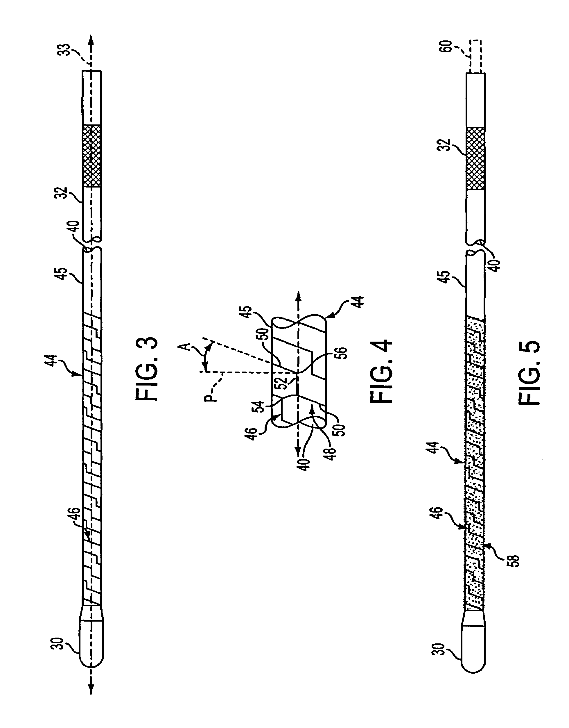 Angled tissue cutting instruments having flexible inner tubular members of tube and sleeve construction