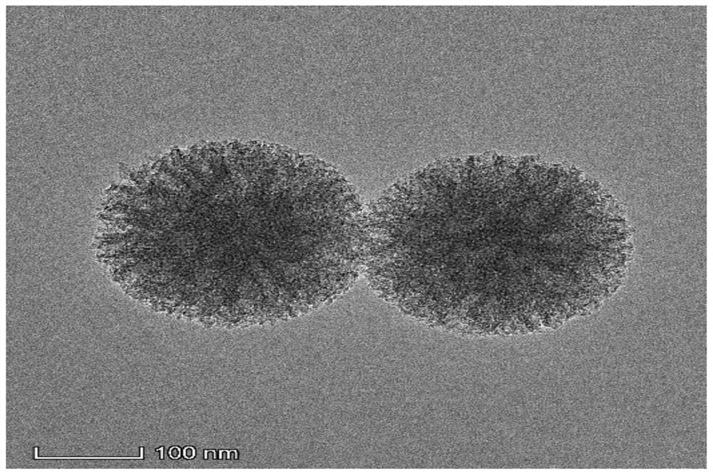 Preparation method and application of anti-ultraviolet dendritic silicon dioxide nanomaterial