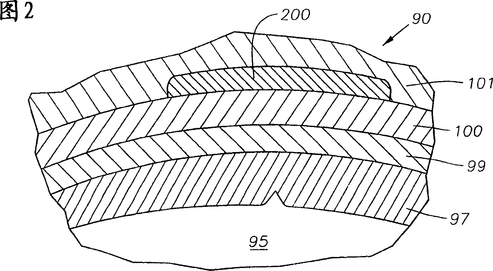 Ophthalmic drug delivery device