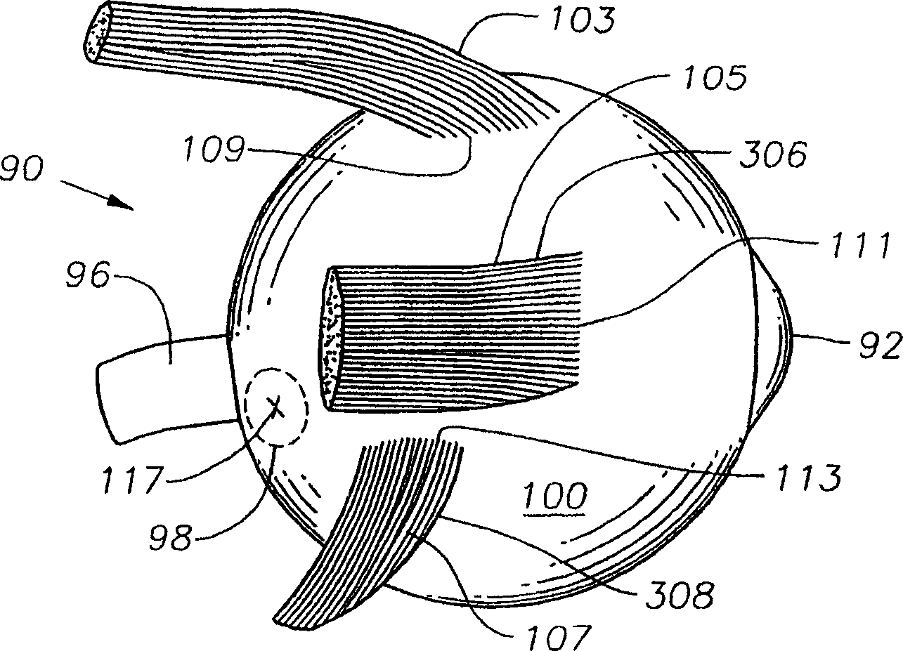 Ophthalmic drug delivery device