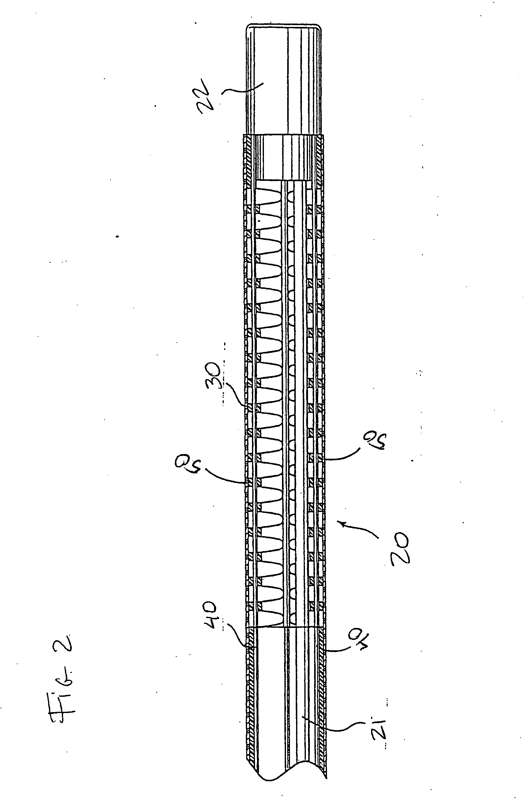 Method for forming an endoscope articulation joint