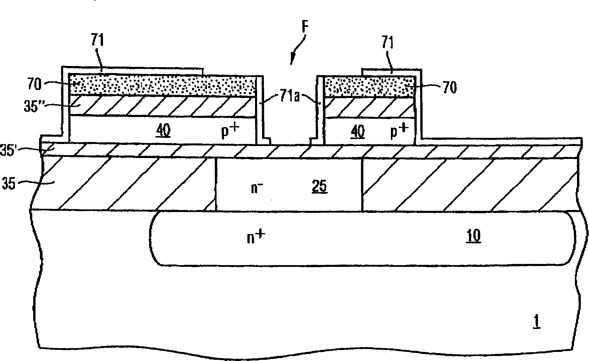 Method for the production of a bipolar semiconductor component and corresponding bipolar semiconductor component