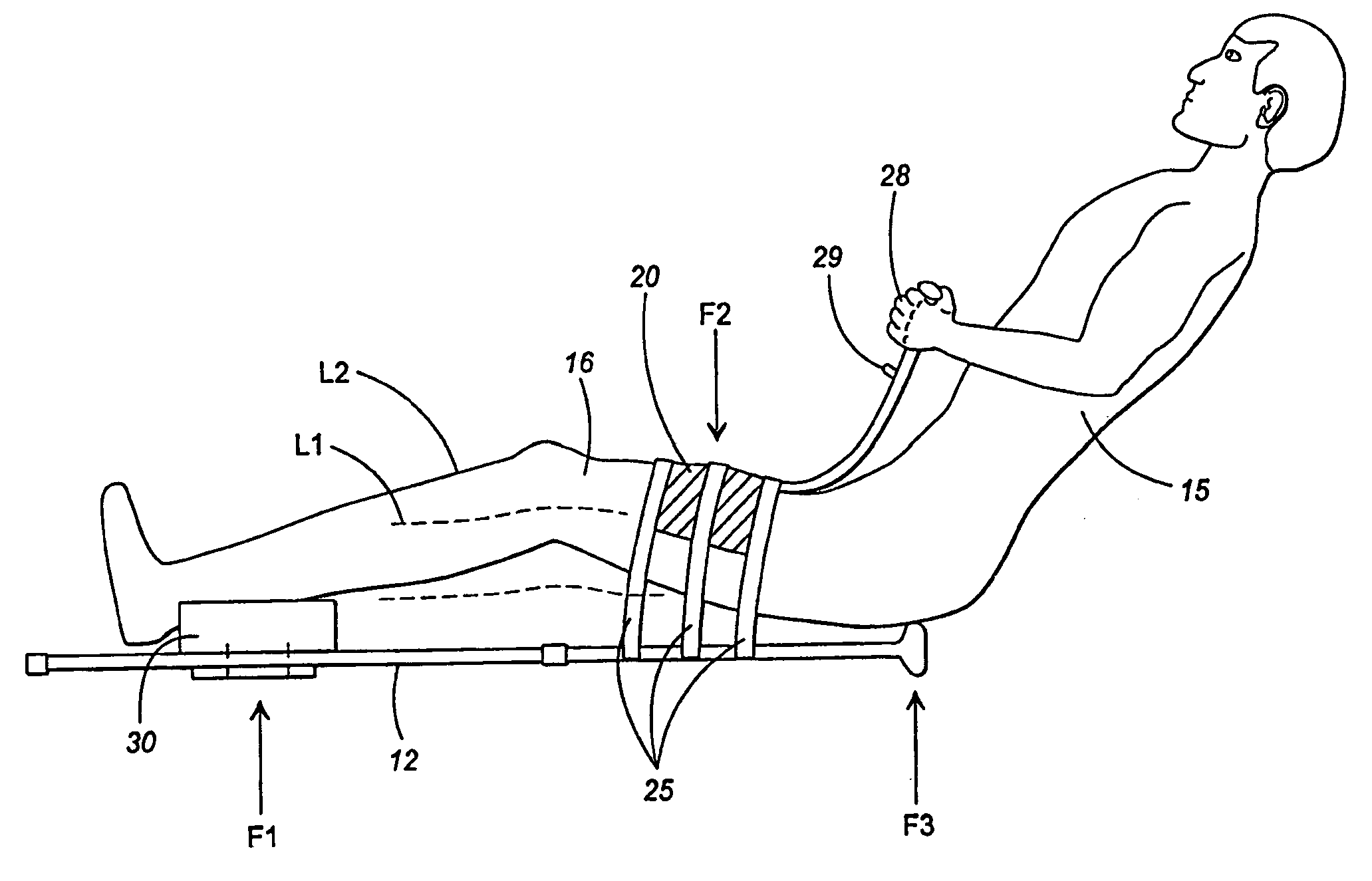 Orthotic apparatus and method for using same