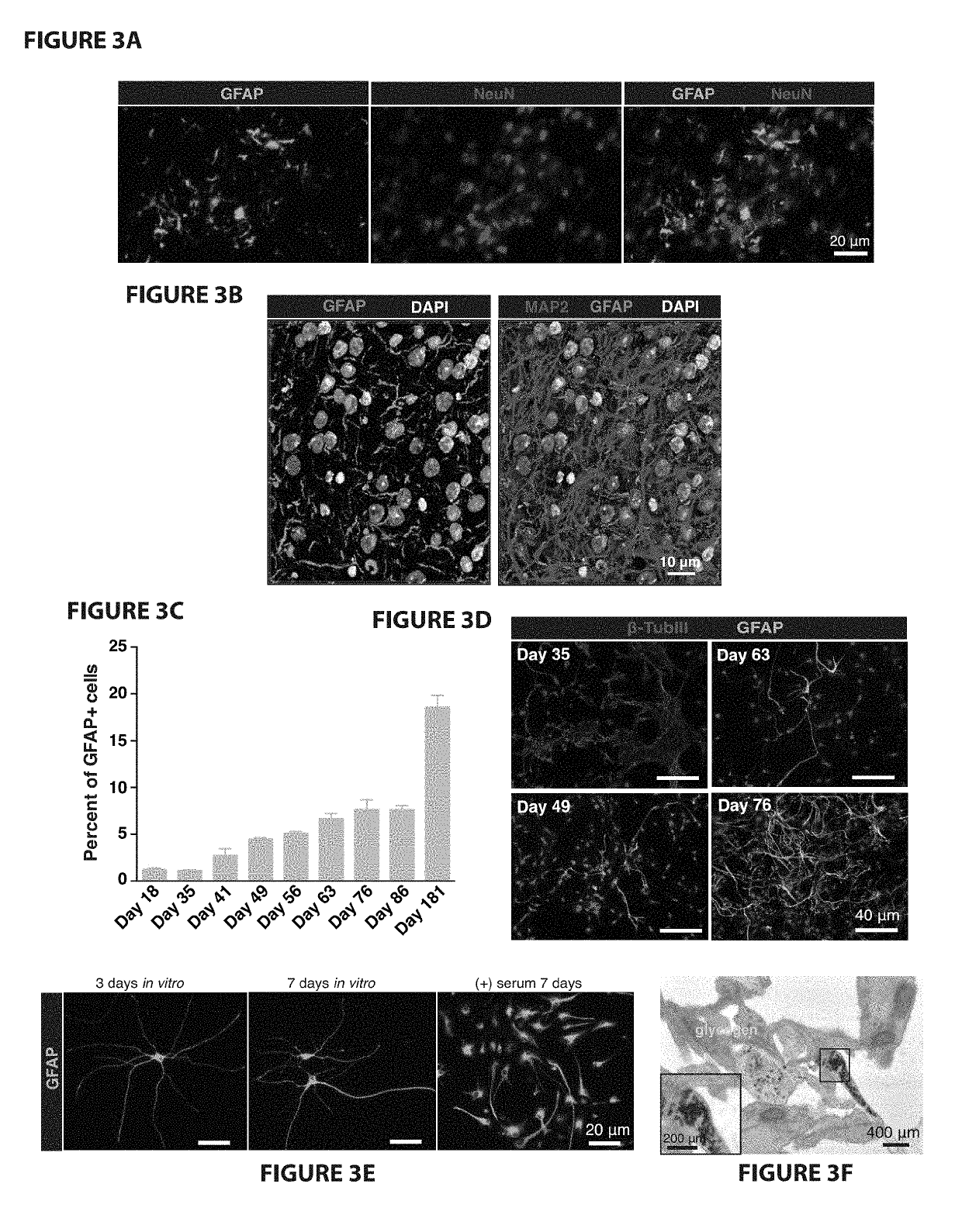 Functional astrocytes and cortical neurons from induced pluripotent stem cells and methods of use thereof