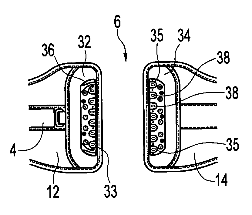 Orthosis closure system with mechanical advantage