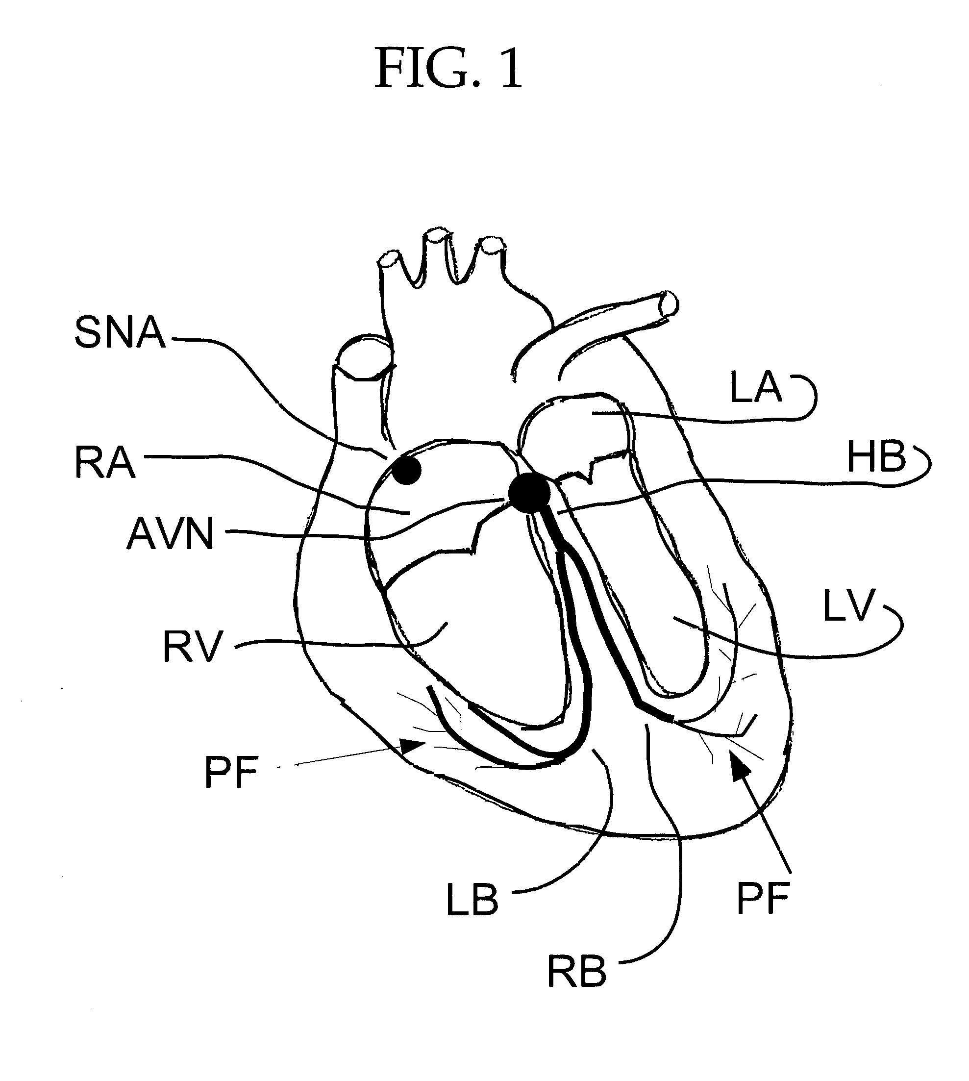 Cell electric stimulator with subsurface electrodes for electric field shaping and separate electrodes for stimulation