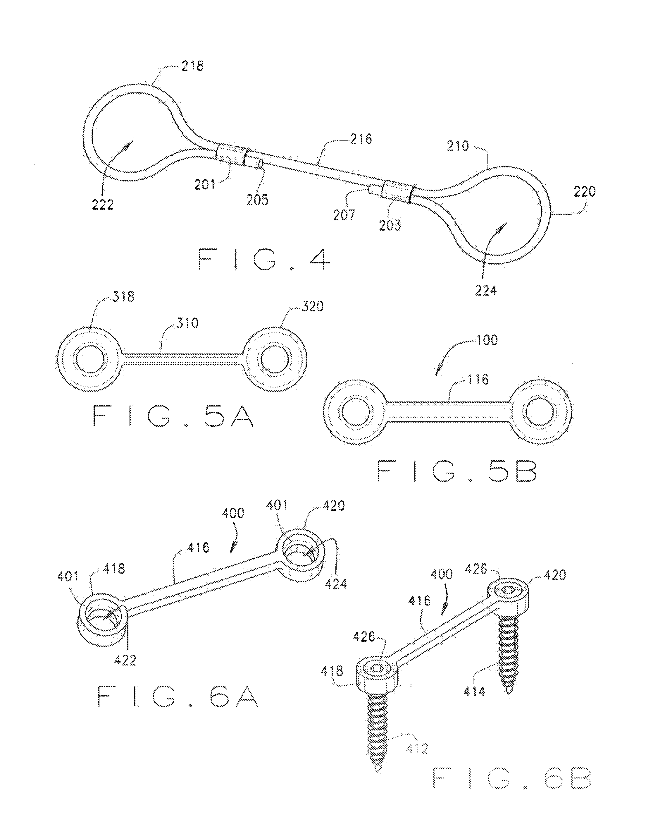 Systems and methods for correcting a rotational bone deformity