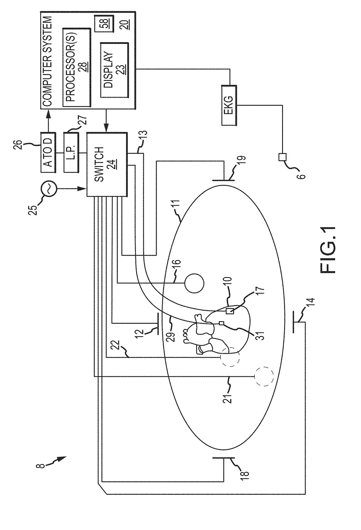 System and Method for Generating Premature Ventricular Contraction Electrophysiology Maps