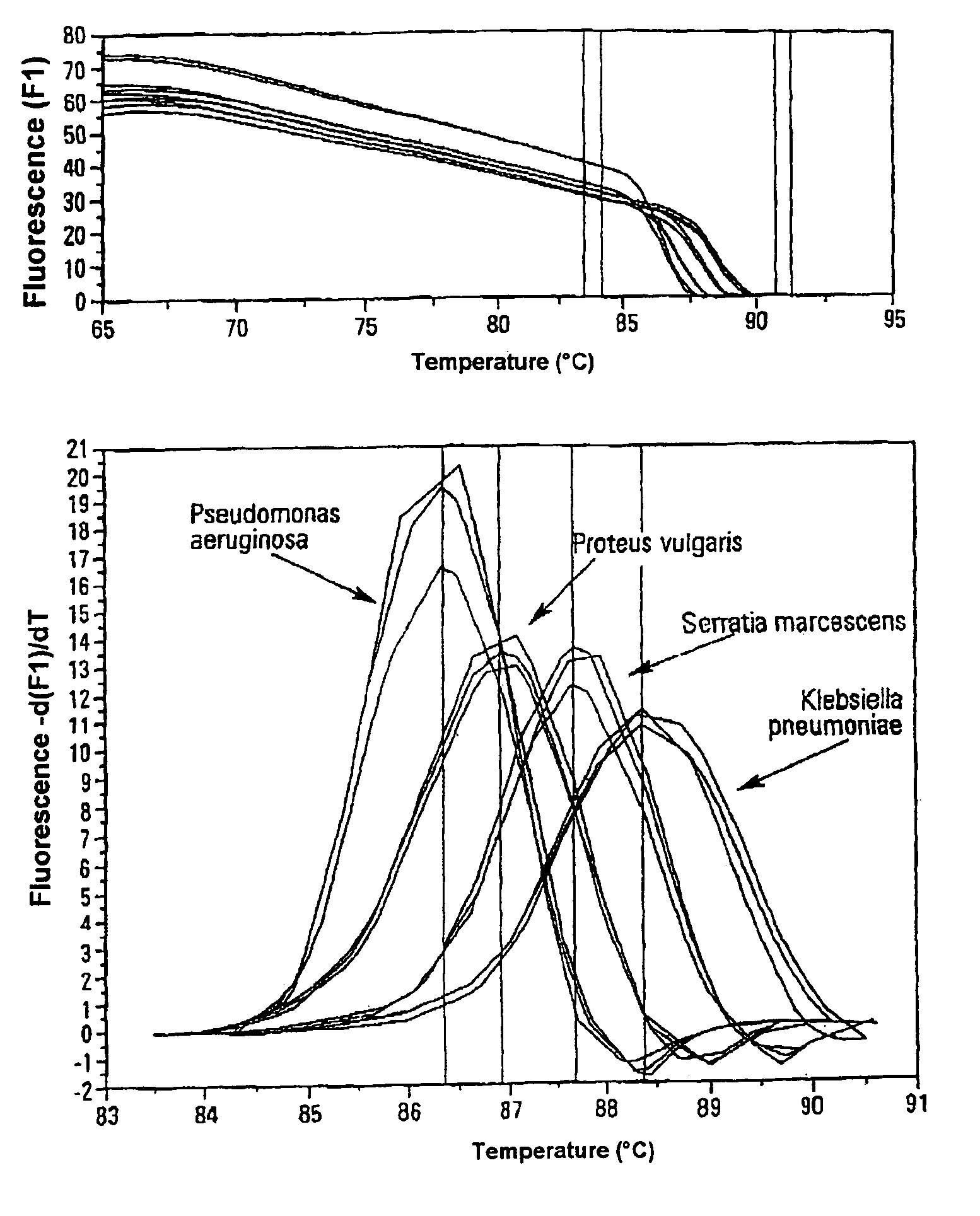 Method for indentifying microbial DNA or RNA