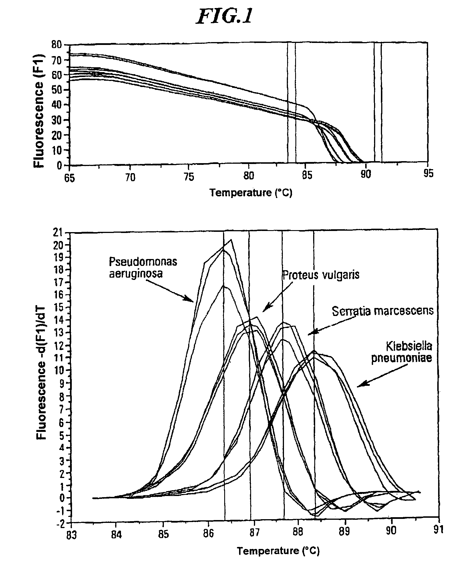 Method for indentifying microbial DNA or RNA
