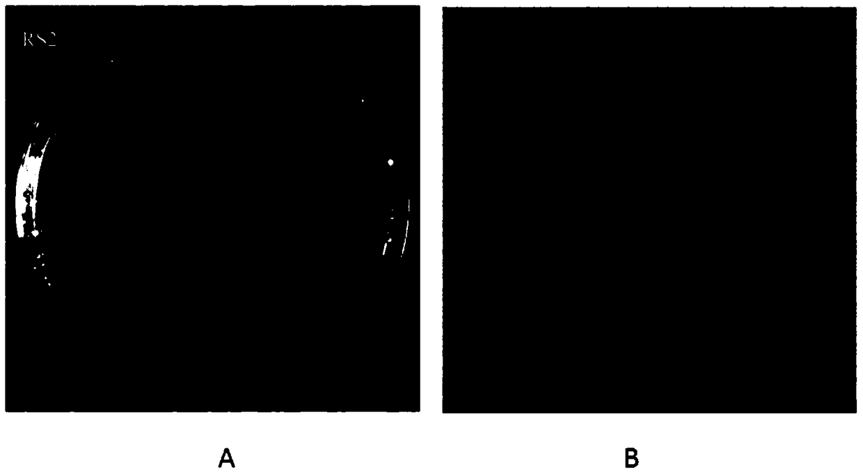 A film-forming bacterium rs2 on the root surface with phenanthrene degradation function and its application