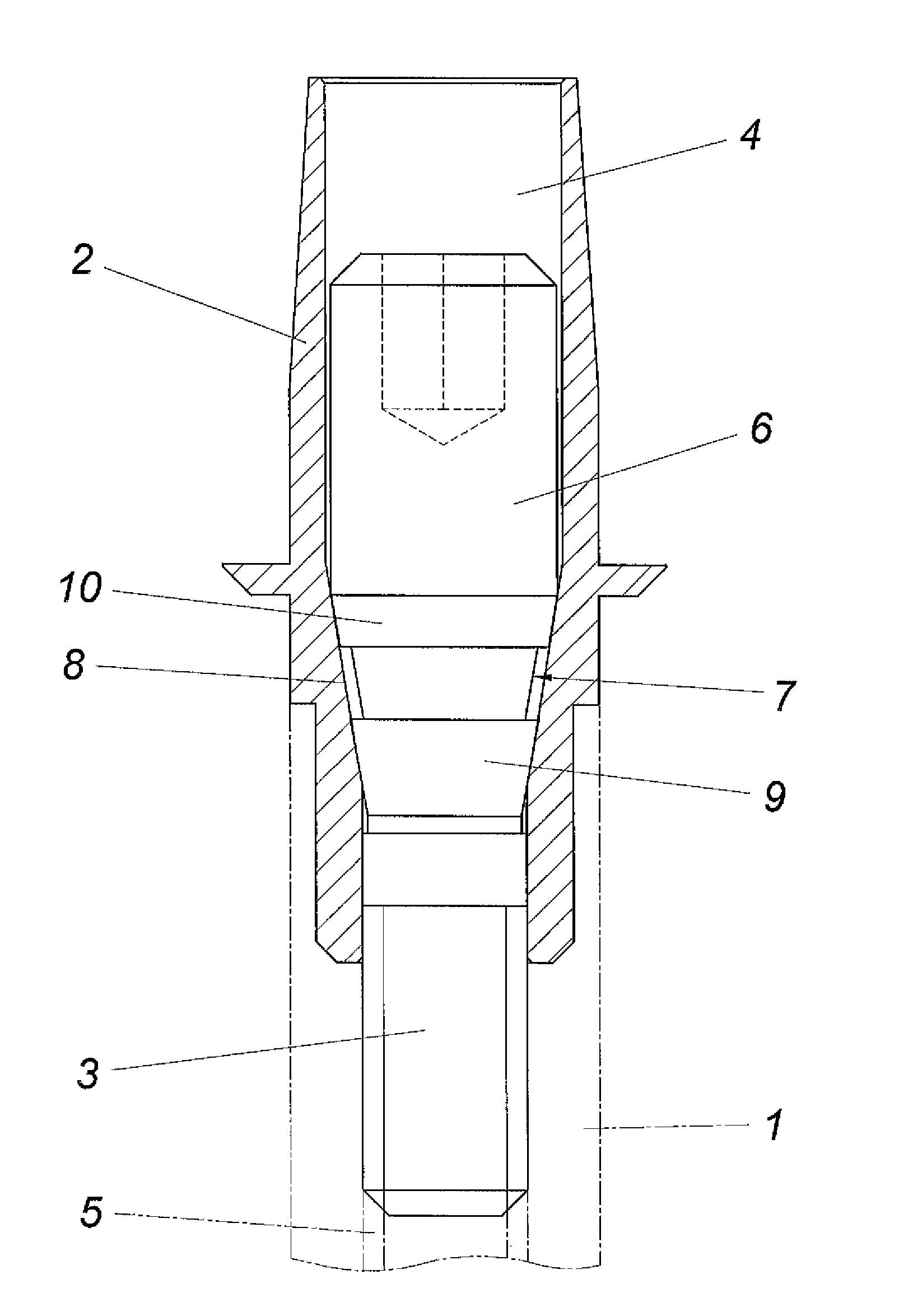 Dental prosthesis