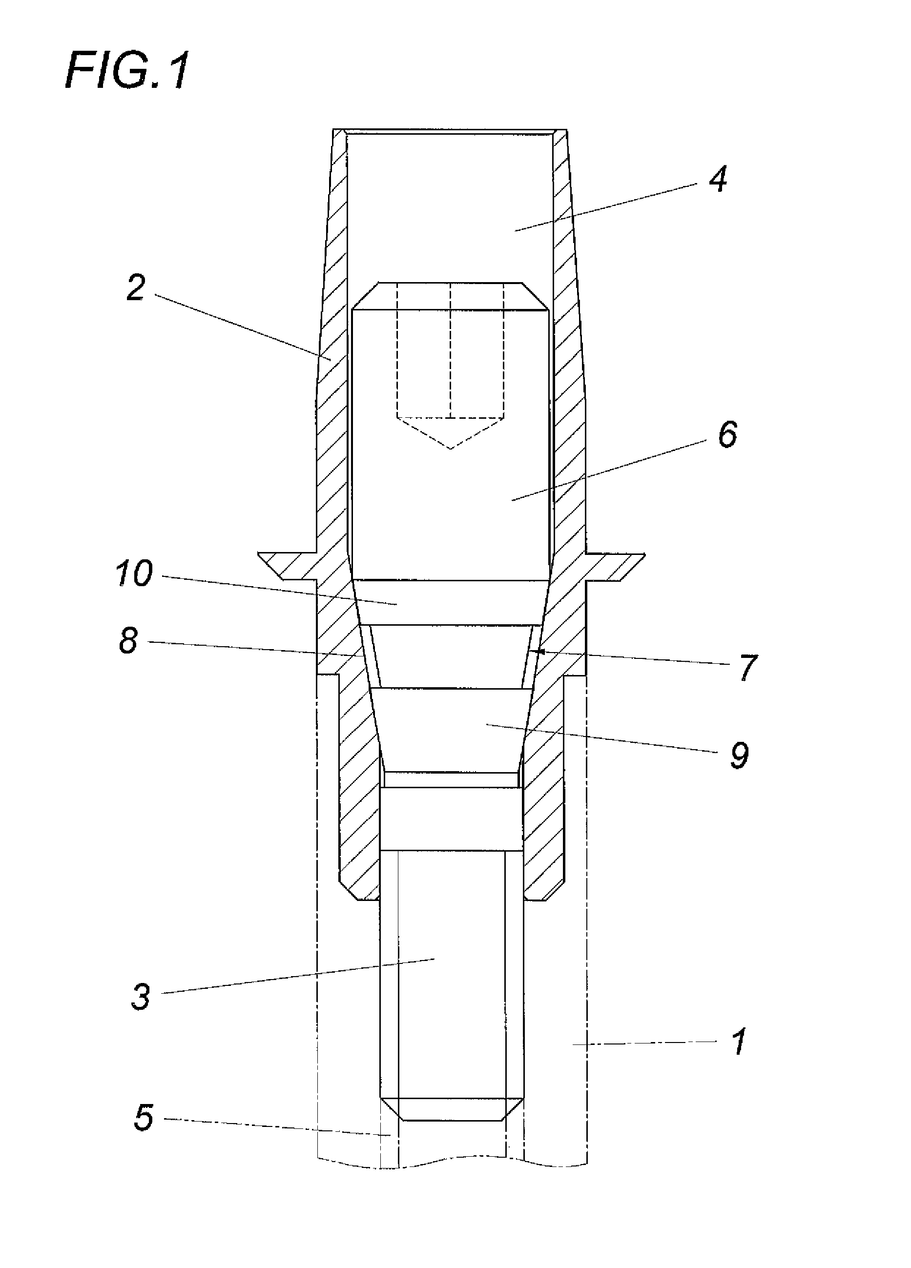 Dental prosthesis