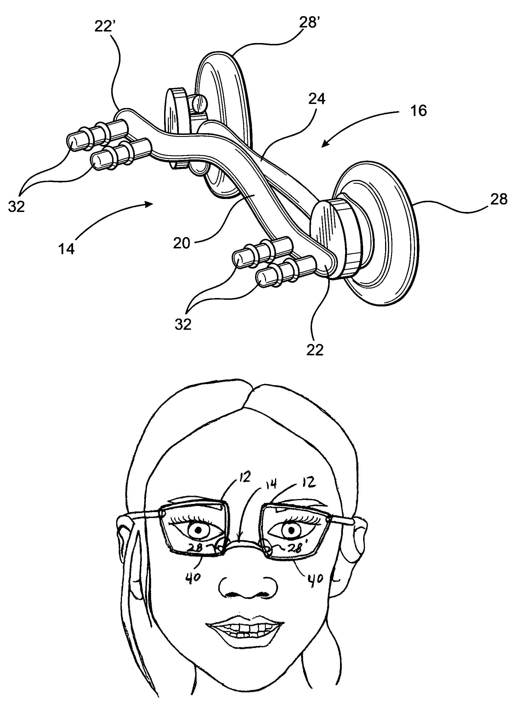 Spectacle assembly for faces without a prominent upper nasal support