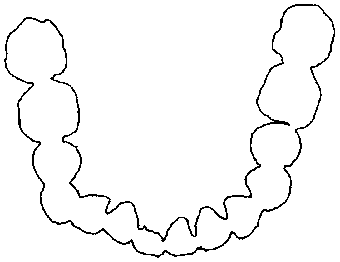 Tooth segmentation method based on peak clustering