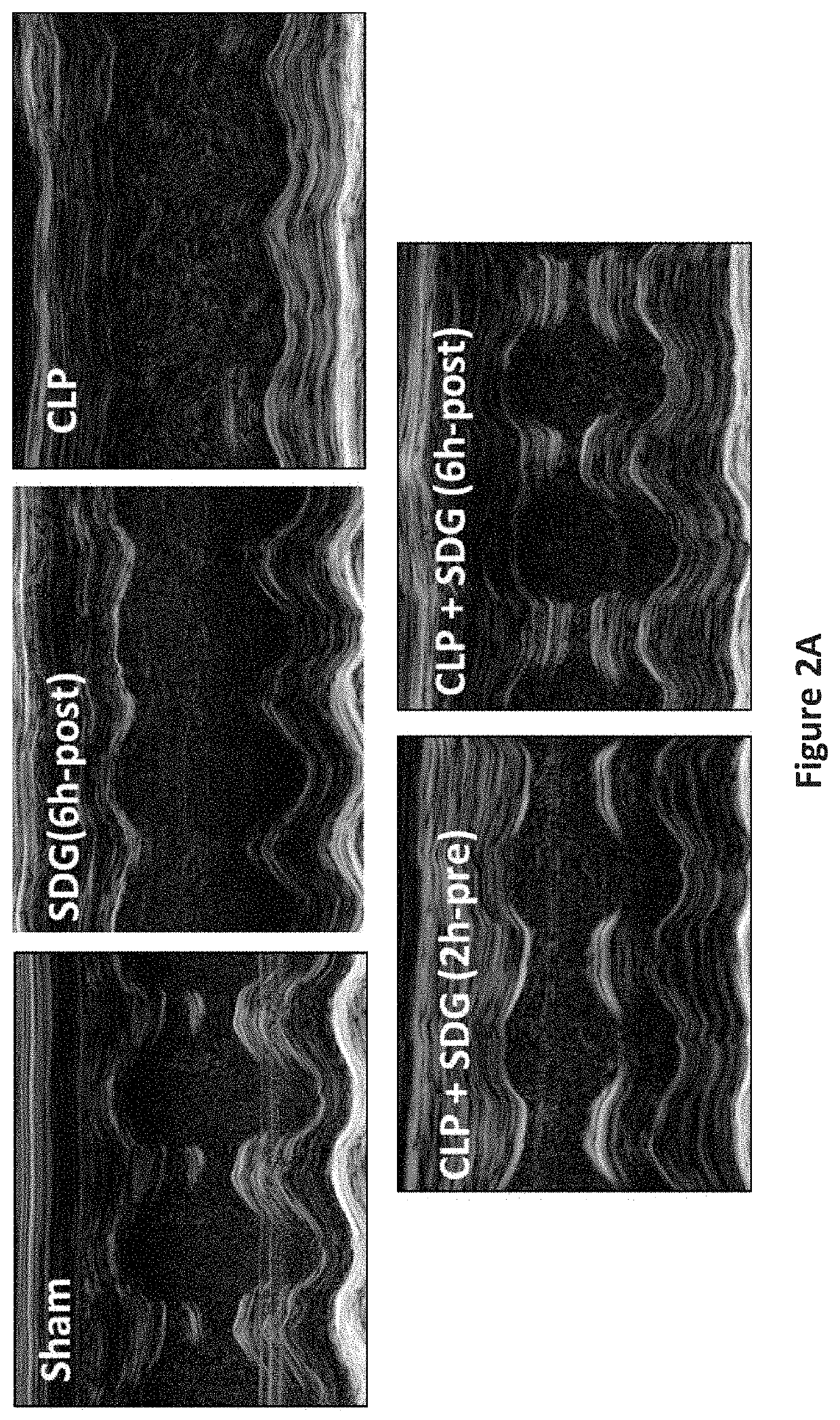 Compositions and methods for treating septic cardiomyopathy