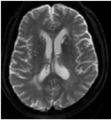 Noninvasive measuring method of microstructure of biological tissue