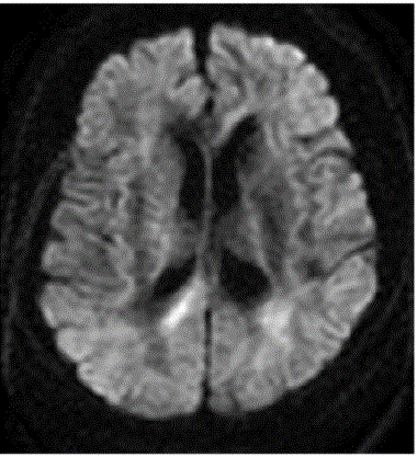 Noninvasive measuring method of microstructure of biological tissue