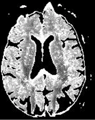 Noninvasive measuring method of microstructure of biological tissue