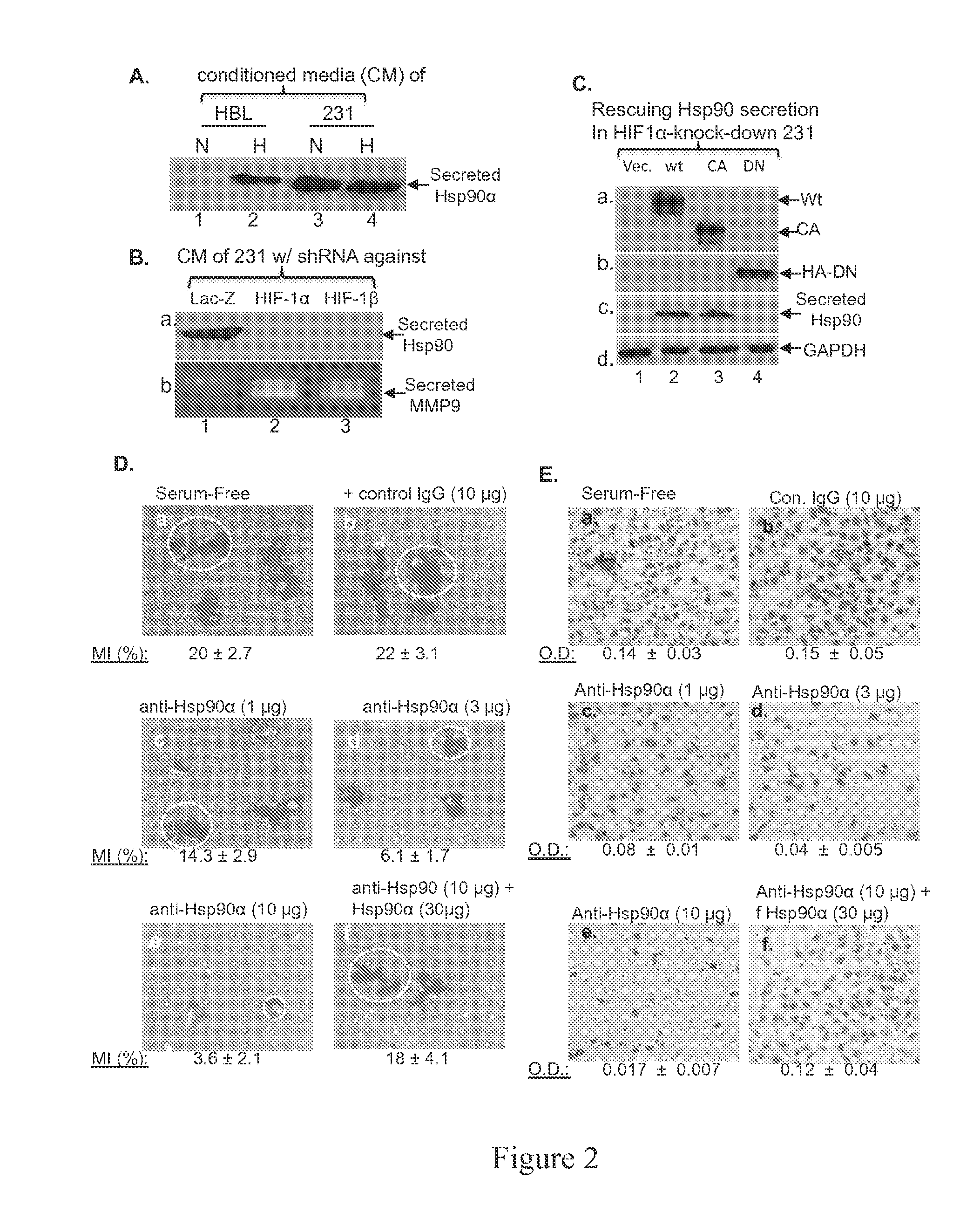 Fragment of secreted heat shock protein-90alpha (hsp90alpha) as vaccines or epitope for monoclonal antibody drugs or target for small molecule drugs against a range of solid human tumors