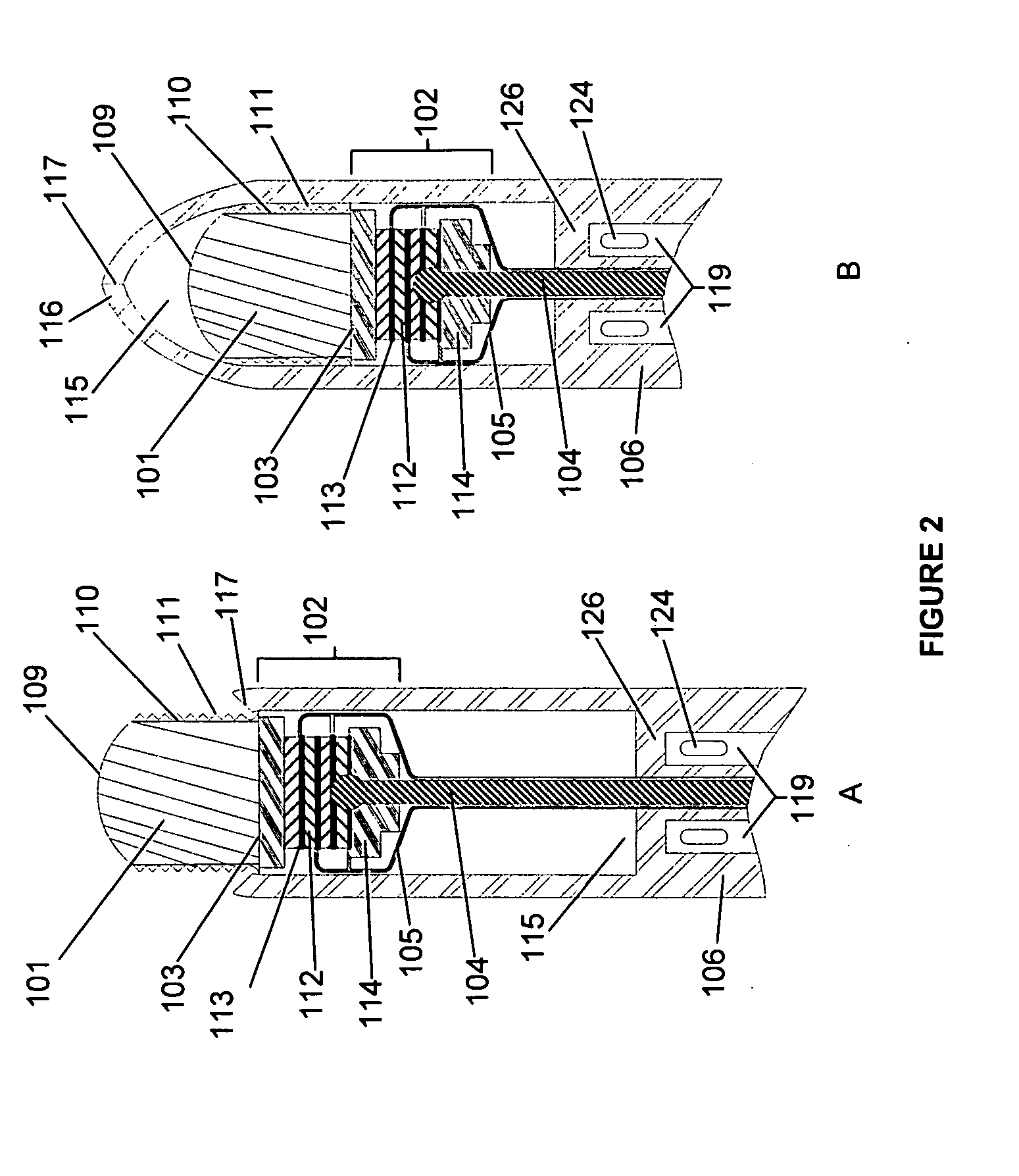 Ablative ultrasonic-cryogenic apparatus