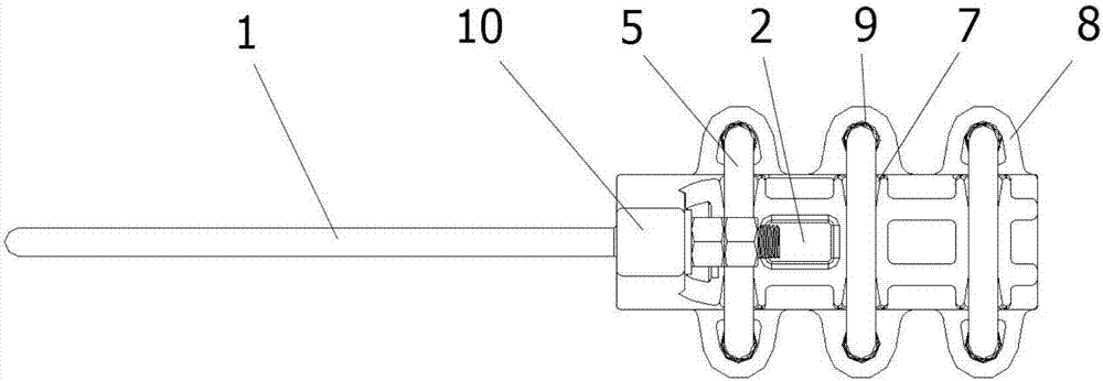 Cable tension clamp