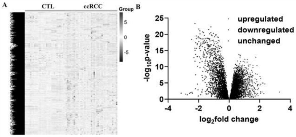 Application of urine microvesicle protein as kidney cancer diagnosis marker