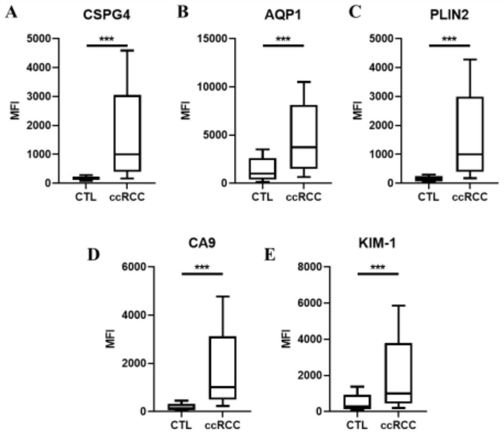 Application of urine microvesicle protein as kidney cancer diagnosis marker