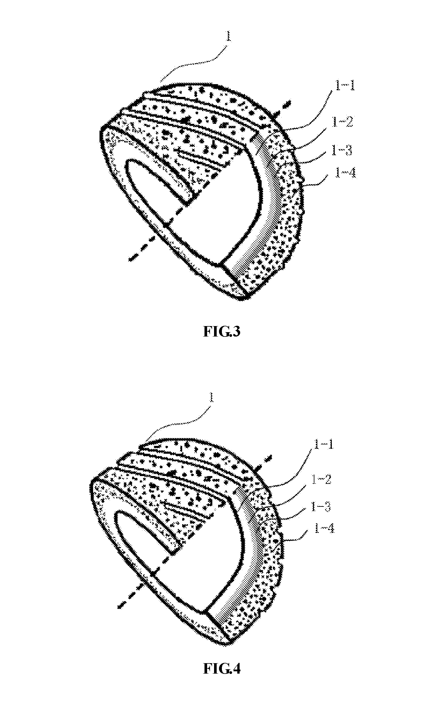 Artificial femoral ball head with multi-layer shell core composite structure