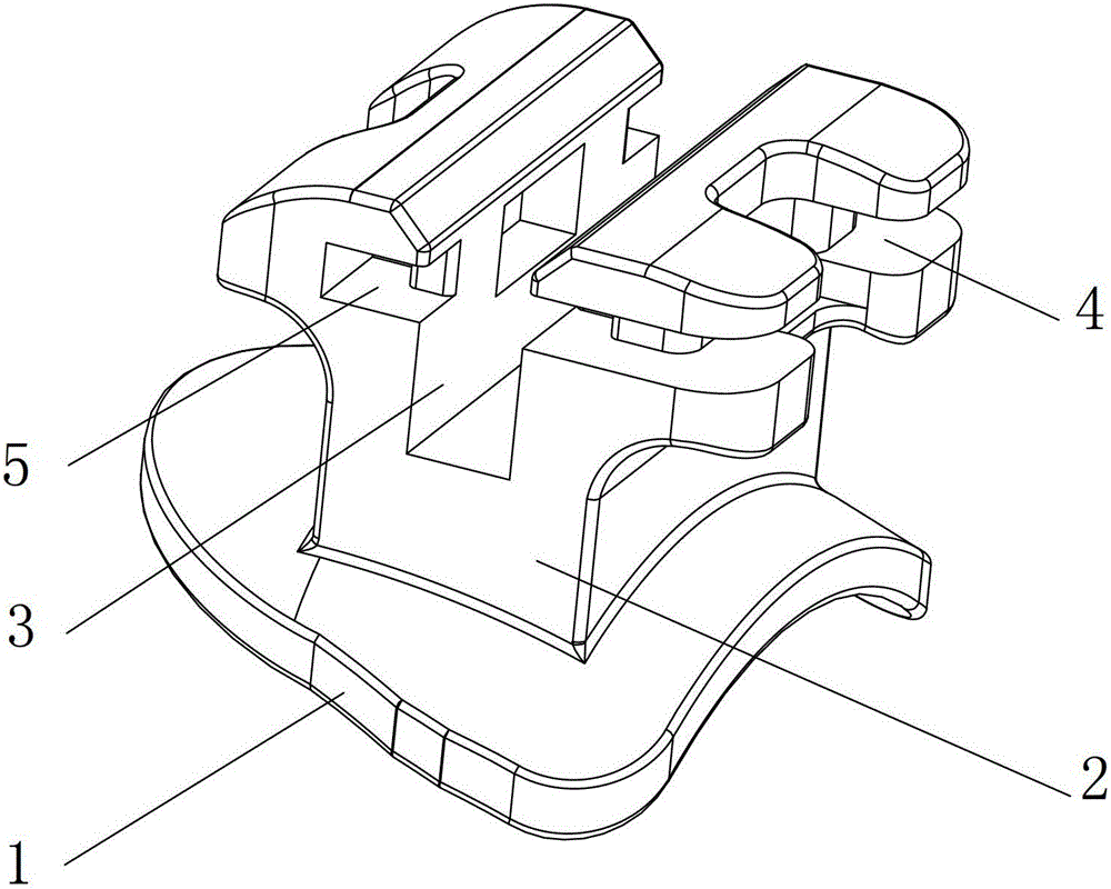 Self-ligating orthodontic brackets for orthodontics