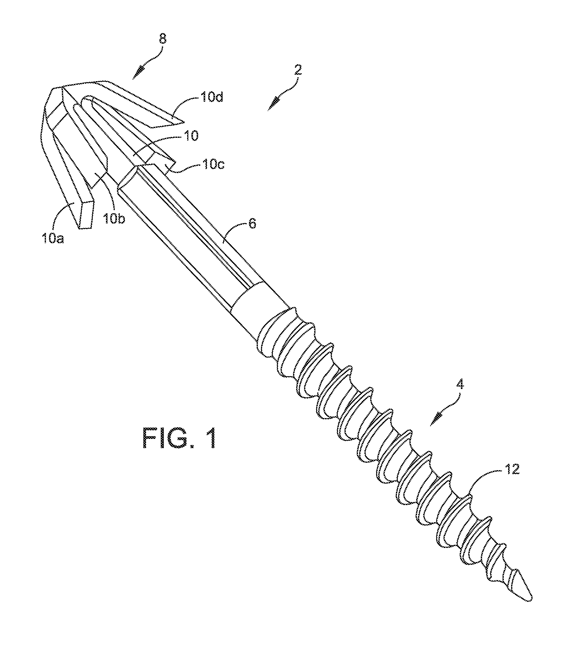 Hammertoe implant and instrument
